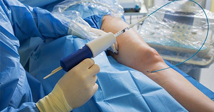 cateterismo cardiaco costo en ecuador