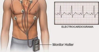 Holter EKG cardiograma cardiólogo cardiología guayaquil