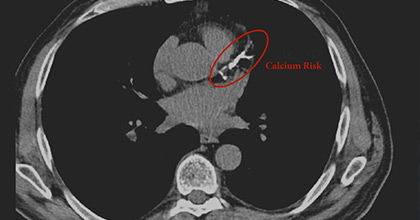 Prueba de calcio Guayaquil
